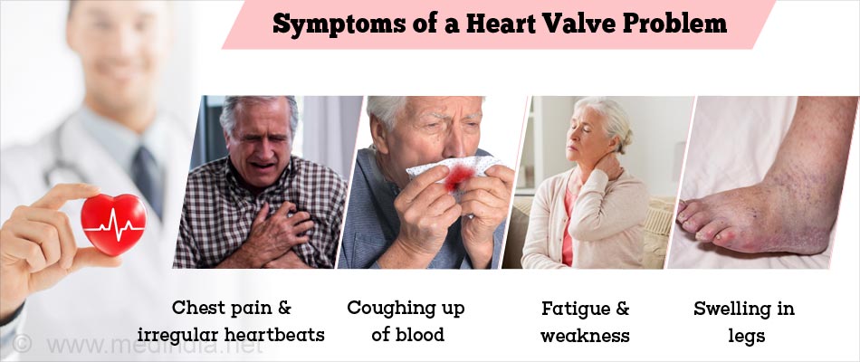 symptoms of a heart valve problem