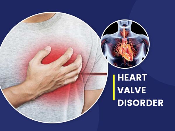 signs heart valve problems
